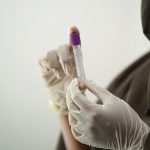 Can I Drink Apple Cider Vinegar Before Blood Test? Preparation Tips